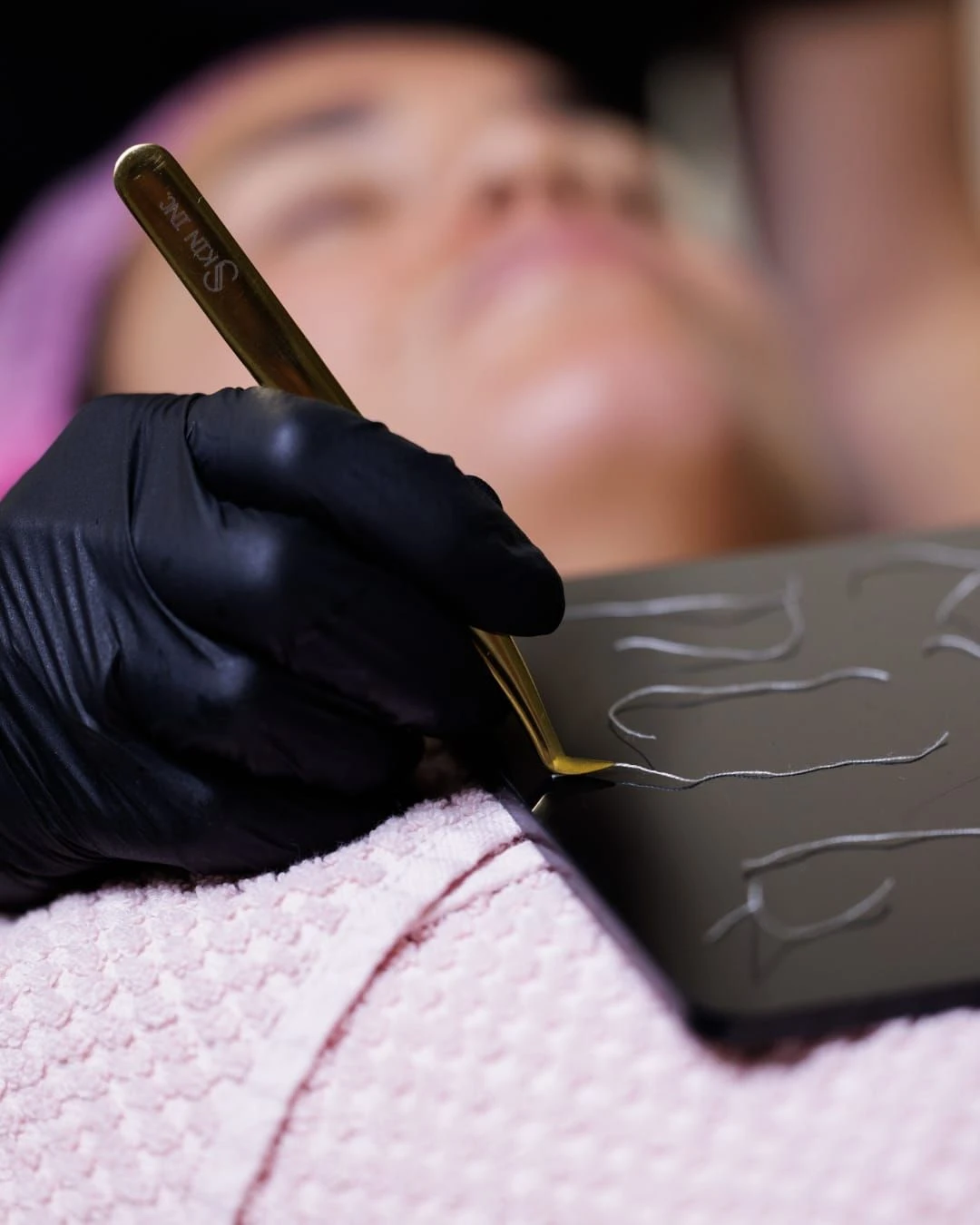 huid verbeterend behandeling