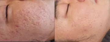 Matt Moisterising Day Fluid vocht in brengende dag  - Foto 4