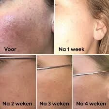 Matt Moisterising Day Fluid vocht in brengende dag  - Foto 6