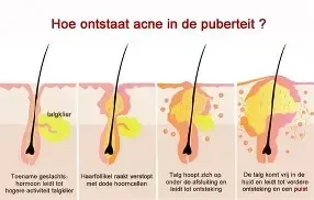 Balancing Purifying Start stet  voor de onzuivere en vette huid  BALANCERENDE ZUIVERENDE OLIEVRIJ   - Foto 12