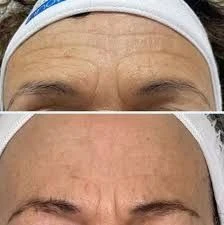 Superlifting Anti-wrinkle Night Cream - Foto 5