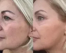 Global Anti-wrinkle Elixer (nacht) - Foto 2