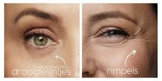 Global Anti-wrinkle Elixer (nacht) - Foto 4