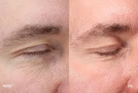 GECONCENTREERD VERSTEVIGEND SERUM 38% Actief Complex TENSILIFT - Foto 6