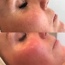  Intense Moisterising  vocht herstellent Anti-age Serum. - Foto 3