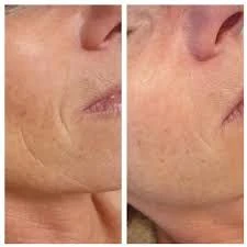 Jelea Real start set   - Foto 3