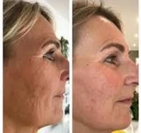 De exclusieve OXIDANCE-set is de perfecte verzorgingscombinatie Antioxidante bescherming en nieuwe energie voor gestreste huid - Foto 4