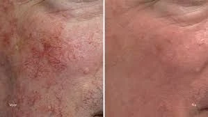 TOLERANTIE GEAVANCEERDE NEURO-CRÈME · GEVOELIGE HUID - Foto 3