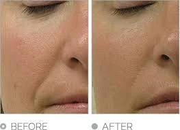 Antioxidant Intense Protection Serum - Foto 4