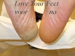 photo - Corrola's Nagelhuys