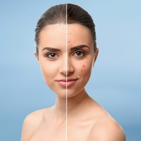 photo - Corrola's Nagelhuys